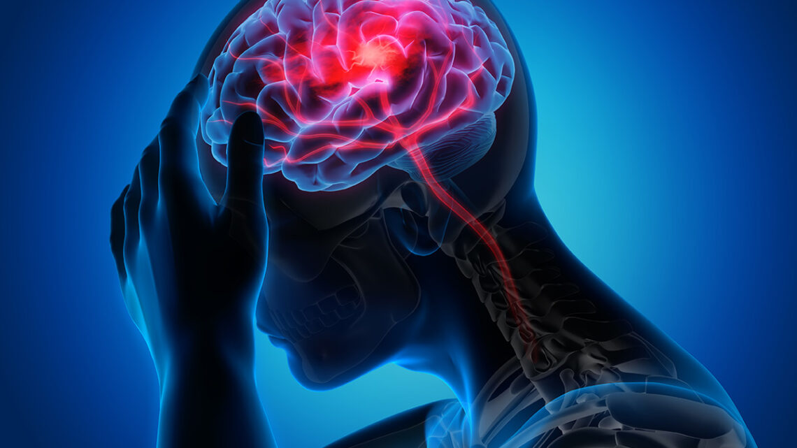 stroke symptoms