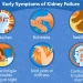 Early Signs of Kidney Failure